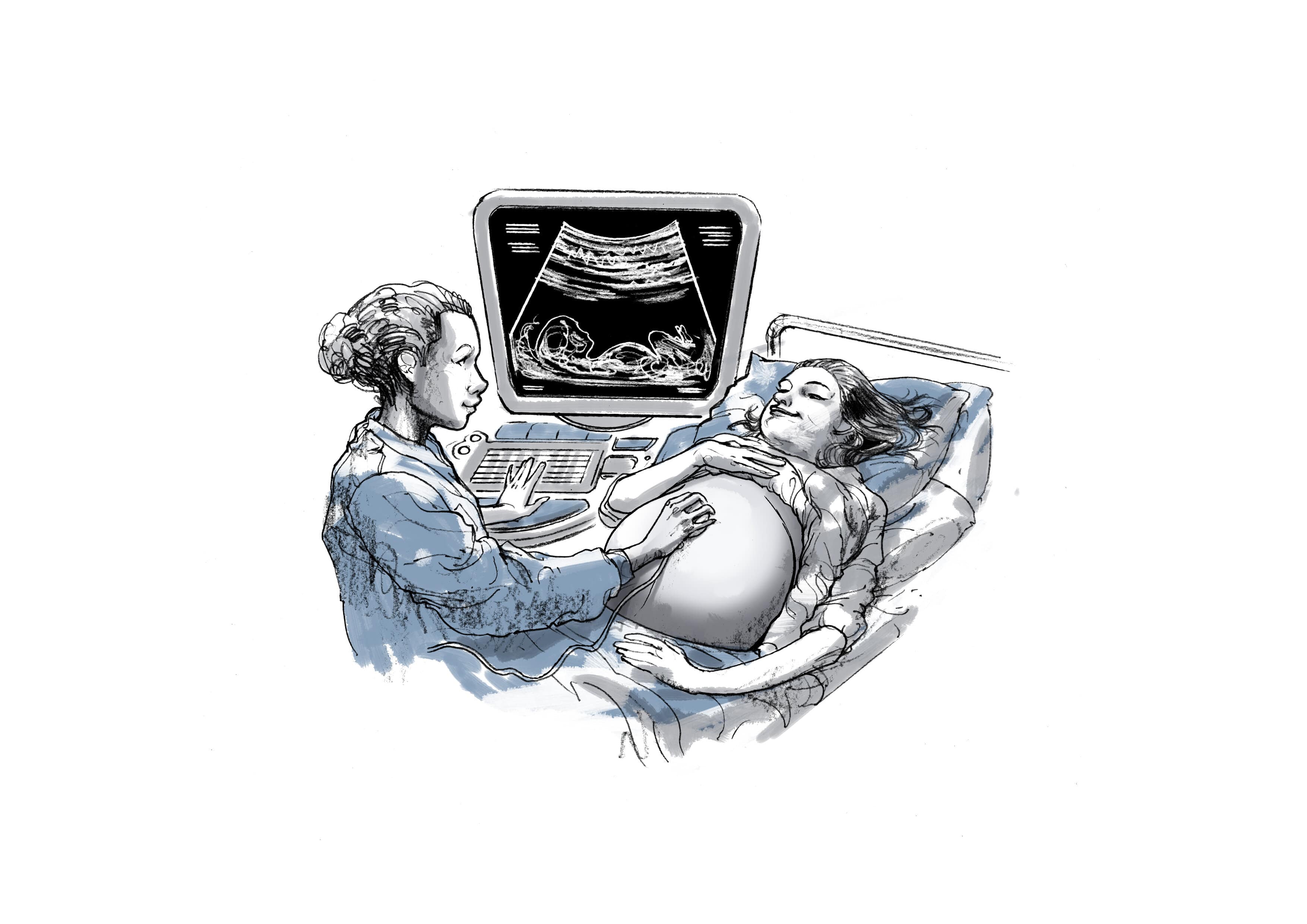 Drawing of ultrasound scanning and imaging